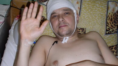 Николаевскому журналисту с завода «Зоря» еще нужна помощь | Корабелов.ИНФО