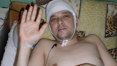 "Беда объединяет", - коллега николаевского журналиста Олега Егорова снова просит помочь ему в лечении | Корабелов.ИНФО