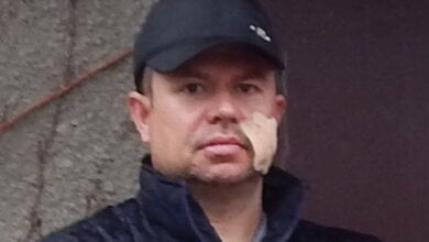 "Он пистолетом ударил меня с размаху по лицу, сразу в крови всё"... Конфликт между двумя семьями в Корабельном районе | Корабелов.ИНФО