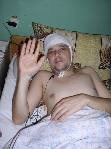 Николаевскому журналисту сделали еще одну операцию. Ему нужна материальная помощь | Корабелов.ИНФО image 2