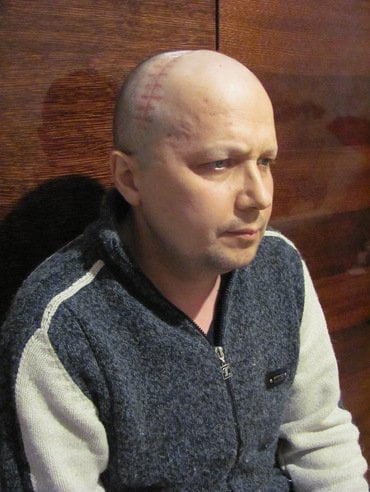 Николаевскому журналисту сделали еще одну операцию. Ему нужна материальная помощь | Корабелов.ИНФО image 3