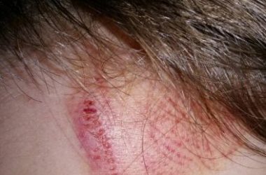 В Николаеве двое 16-летних подростков избили и ограбили 12-летнего школьника (видео) | Корабелов.ИНФО image 7