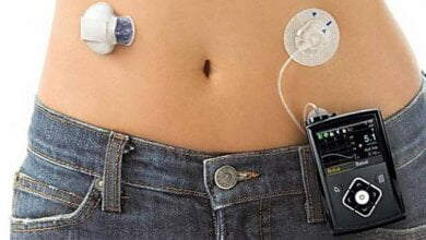 «Искусственная поджелудочная железа и самозавязывающиеся кроссовки», - составлен рейтинг изобретений 2016 года | Корабелов.ИНФО image 1