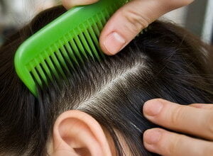 "Я відкидаю всі звинувачення у моїй байдужості", - вчителька щодо проблеми педикульозу в Миколаївській школі № 48 | Корабелов.ИНФО