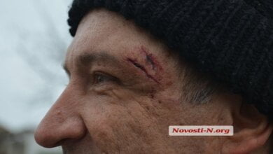 В Витовском районе вооруженный мужчина напал на контролеров "Николаевоблэнерго" | Корабелов.ИНФО image 1