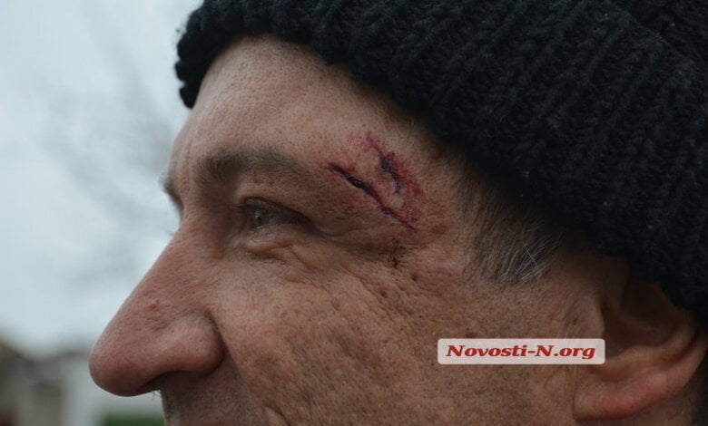 В Витовском районе вооруженный мужчина напал на контролеров "Николаевоблэнерго" | Корабелов.ИНФО image 1