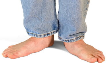 Об опасности плоскостопия - ортопед-травматолог Витовской ЦРБ | Корабелов.ИНФО