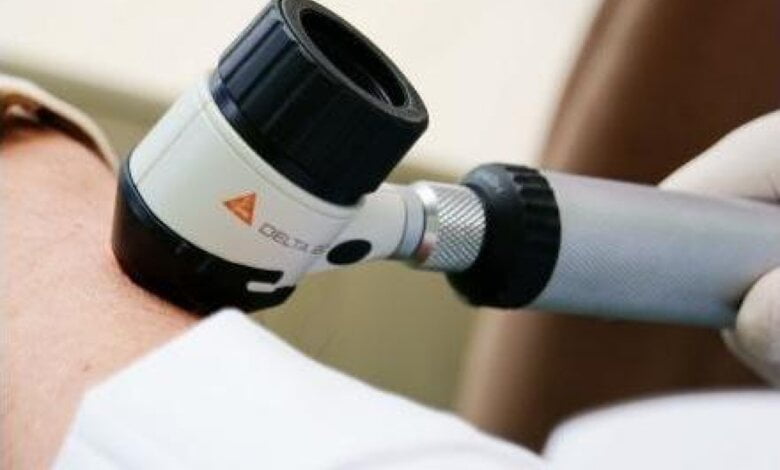 Миколаївців запрошують пройти обстеження до Всесвітнього дня меланоми | Корабелов.ИНФО