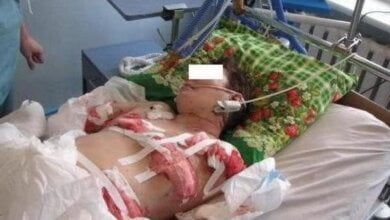 Бродячие собаки убивают николаевцев: статистика (2011 – 2017 гг.) | Корабелов.ИНФО image 4