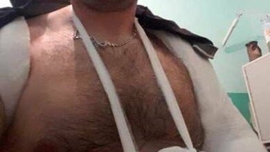 Драка на сессии Николаевского райсовета: депутату сломали руку | Корабелов.ИНФО image 1