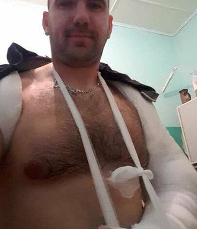 Драка на сессии Николаевского райсовета: депутату сломали руку | Корабелов.ИНФО image 1