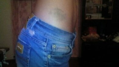 В Николаеве таксист совместно с пассажирами ограбил и избил двух девушек | Корабелов.ИНФО image 1