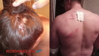 Группа подростков в ночном клубе Корабельного района зверски избила мужчину | Корабелов.ИНФО