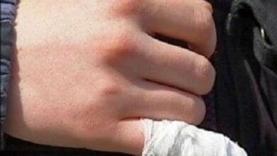 Во время драки на Николаевщине мужчине откусили мизинец | Корабелов.ИНФО image 1