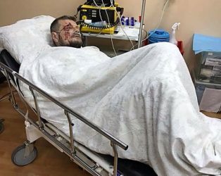 Возле здания телеканала в Киеве произошел взрыв: ранен нардеп Мосийчук и другие, двое погибших | Корабелов.ИНФО image 5