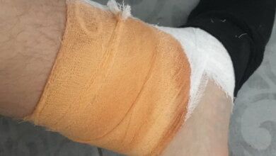 Если Вас укусила бродячая собака: "квест" для николаевцев | Корабелов.ИНФО image 1