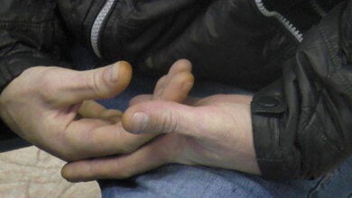 "Любовь" к тестю, приправленная водочкой: 34-летний николаевец "нечаянно" избил родственника - пострадавший в реанимации | Корабелов.ИНФО