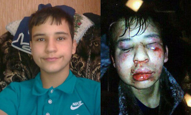 В России подростки до полусмерти избили школьника-инвалида (Видео 18+) | Корабелов.ИНФО