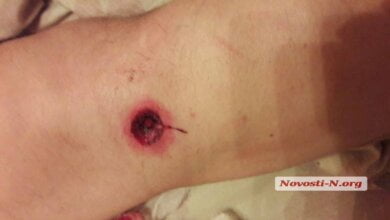 Два адвоката устроили перестрелку на автостоянке в Николаеве: оба ранены | Корабелов.ИНФО