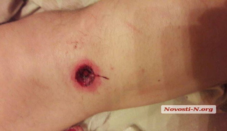 Два адвоката устроили перестрелку на автостоянке в Николаеве: оба ранены | Корабелов.ИНФО