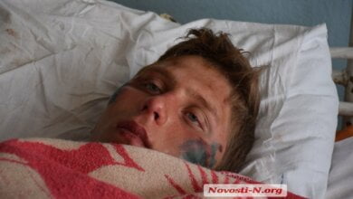 Парень из Витовского района обвинил полицейских в избиении: у пострадавшего тяжелые переломы (видео) | Корабелов.ИНФО image 2