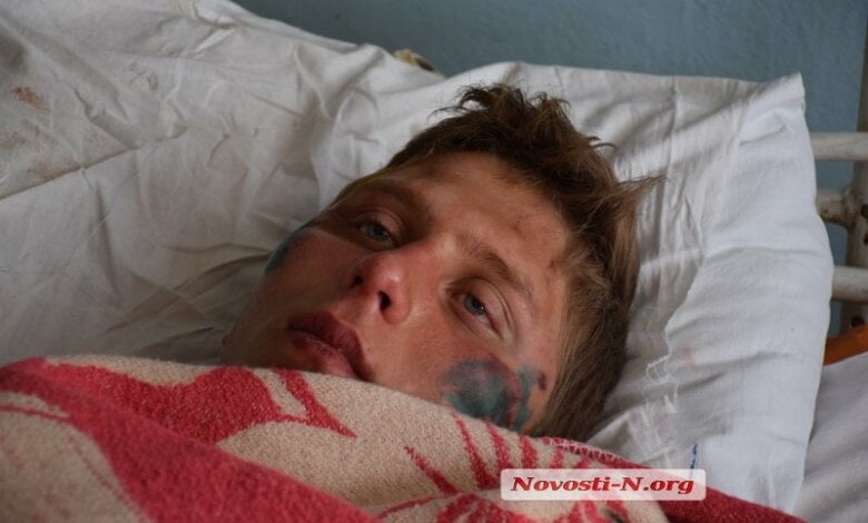 Парень из Витовского района обвинил полицейских в избиении: у пострадавшего тяжелые переломы (видео) | Корабелов.ИНФО image 2