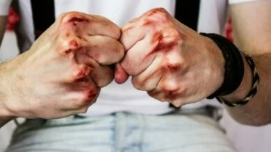 В Корабельном районе жестоко избили гражданина Германии | Корабелов.ИНФО
