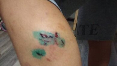 Искусала до крови: бродячая собака напала на подростка в Корабельном районе | Корабелов.ИНФО image 3