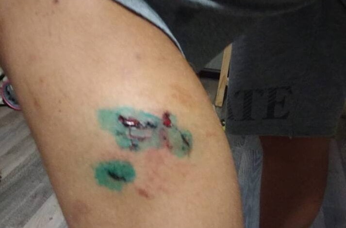 Искусала до крови: бродячая собака напала на подростка в Корабельном районе | Корабелов.ИНФО image 3