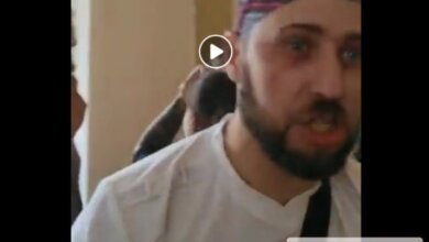 "Зоошиза" в здании Николаевской мэрии покусала активиста и чуть не выцарапала ему глаз (ВИДЕО 18+) | Корабелов.ИНФО
