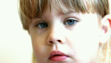 Трехлетней Алёнушке из Корабельного района, нуждающейся в пересадке костного мозга, срочно требуется помощь | Корабелов.ИНФО image 1