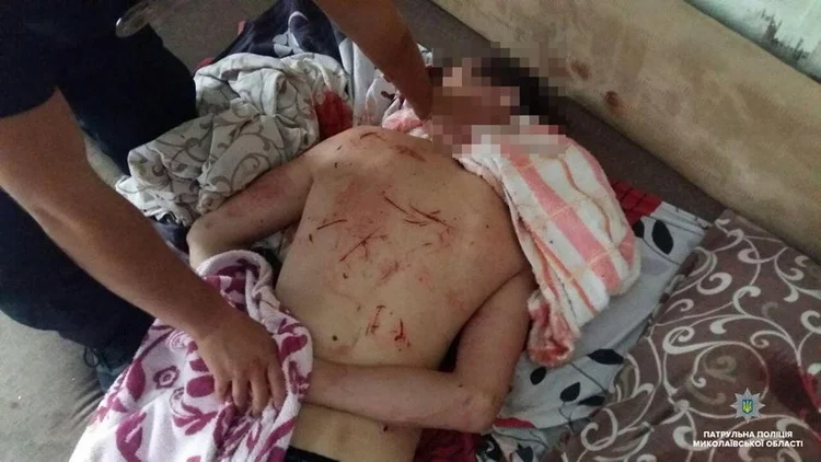 Под действием наркотиков николаевец изрезал себя ножом и разгромил квартиру. ФОТО (18+) | Корабелов.ИНФО image 3