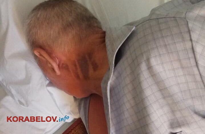 Сломаны челюсть и 7 ребер, пробито лёгкое. Дальнобойщики мочились на диспетчерскую и избили "маршрутчика" за замечание им | Корабелов.ИНФО