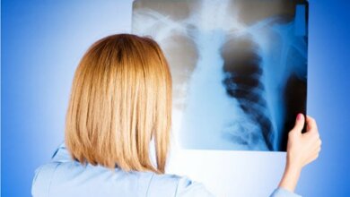 Пленка закупается: 65 пациентов в день могли бы сделать рентген бесплатно в Николаевской областной больнице | Корабелов.ИНФО