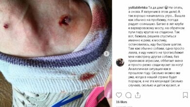 «Куплю, с*ка, ружье теперь точно»: в Николаеве собака напала на девушку, совершавшую утреннюю пробежку | Корабелов.ИНФО