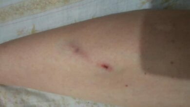 "Выходи, тварь конченая": жительница Николаева пожаловалась, что ее избили и выбросили из троллейбуса | Корабелов.ИНФО image 2