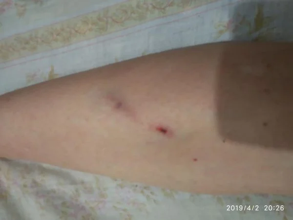 "Выходи, тварь конченая": жительница Николаева пожаловалась, что ее избили и выбросили из троллейбуса | Корабелов.ИНФО image 2
