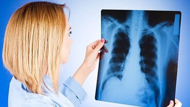 У школьницы в Николаеве – туберкулез. Родители учеников заявляют об "эпидемии" | Корабелов.ИНФО