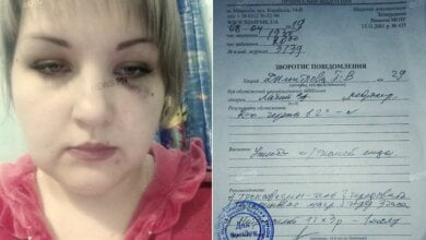 Житель Николаева избил соседку, дети которой «слишком громко бегают» (видео) | Корабелов.ИНФО