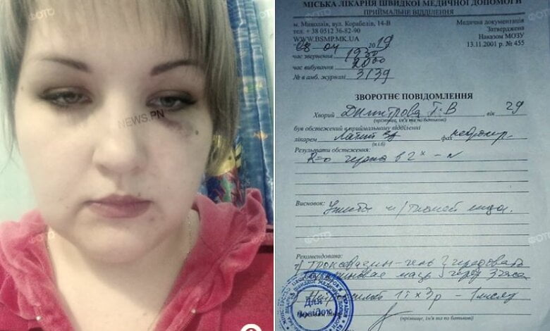 Житель Николаева избил соседку, дети которой «слишком громко бегают» (видео) | Корабелов.ИНФО