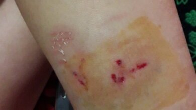 В Николаеве после столкновения с «Шевроле» «Фольксваген» перевернулся на крышу | Корабелов.ИНФО image 5