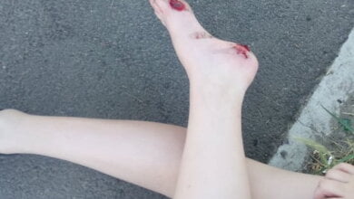 Частная «скорая» в Николаеве сбила школьницу на переходе и скрылась с места ДТП | Корабелов.ИНФО image 2