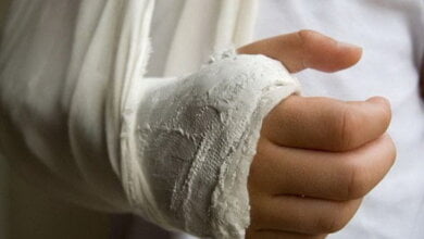 "Ребенку сломали руку, а им бы "не запятнать честь школы", - у мамы пострадавшего "сердце разрывается на части от этой безнаказанности" | Корабелов.ИНФО image 4