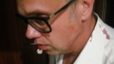 В Николаеве ночью неизвестные напали на кандидата в народные депутаты | Корабелов.ИНФО