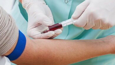 Миколаївці зможуть безкоштовно пройти тестування на гепатит С та отримати консультацію лікарів | Корабелов.ИНФО image 5