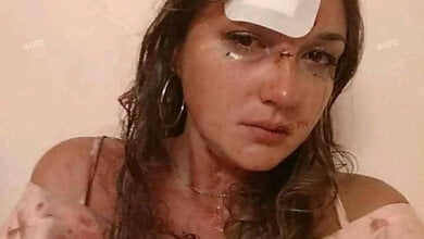 Николаевской девушке во время конфликта в ночном клубе разбили голову | Корабелов.ИНФО