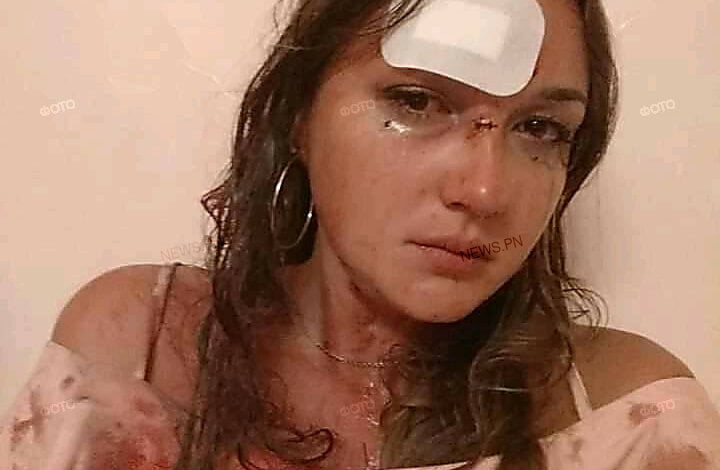 Николаевской девушке во время конфликта в ночном клубе разбили голову | Корабелов.ИНФО