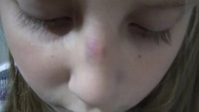 Школьники в Керчи избили новенькую: девочке сломали нос | Корабелов.ИНФО