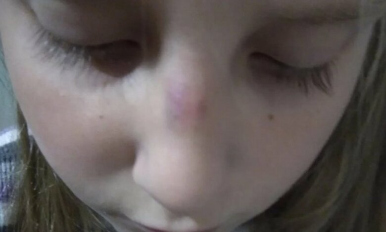 Школьники в Керчи избили новенькую: девочке сломали нос | Корабелов.ИНФО