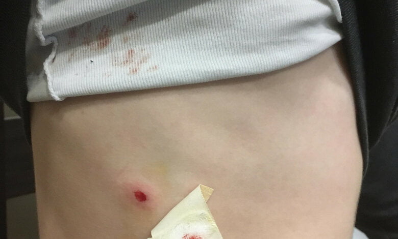 В Николаевской школе подросток подстрелил с пневматической винтовки одноклассника | Корабелов.ИНФО